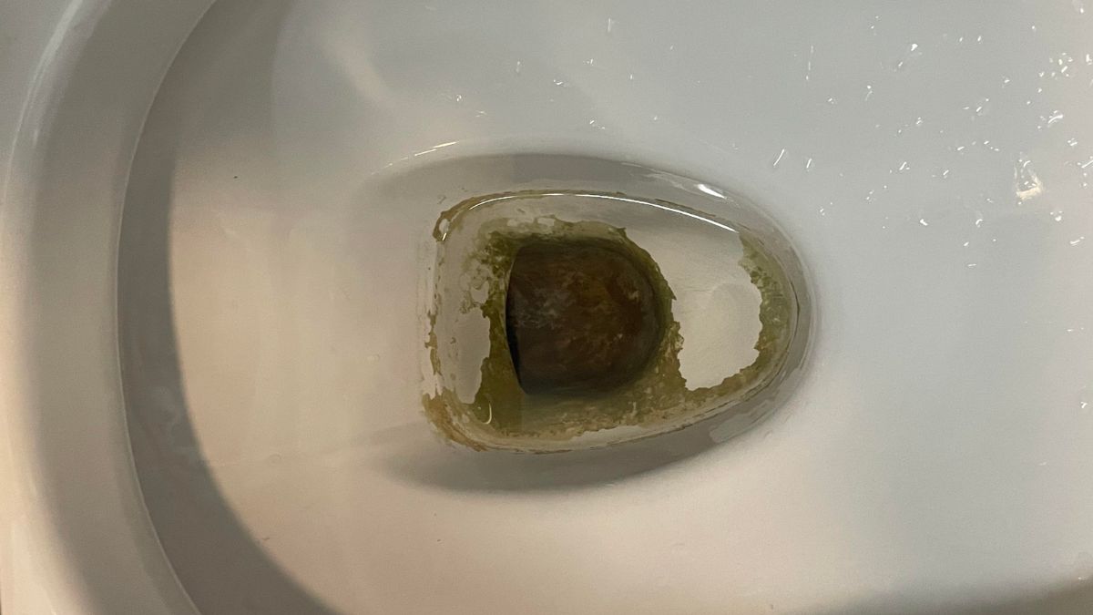 Can mucus plug come out while peeing?