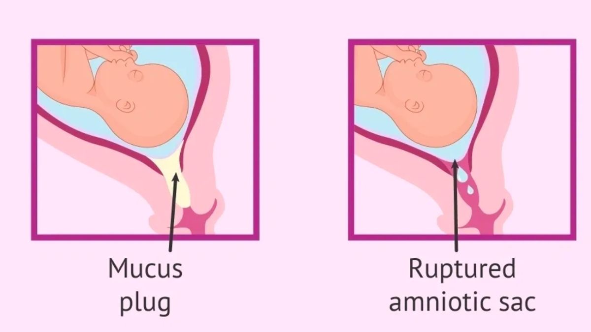 FAQs about your mucus plug in addition to wondering about the size